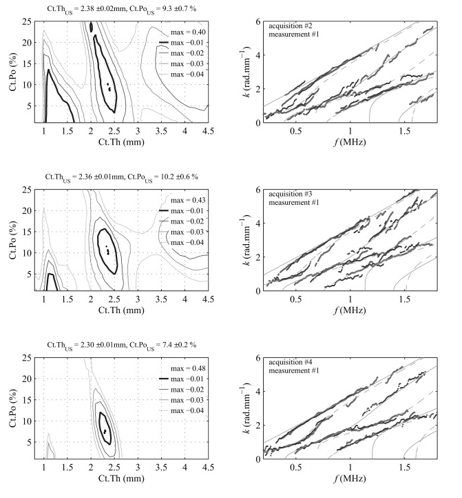 BDAT09 Exvivo Bone2018
